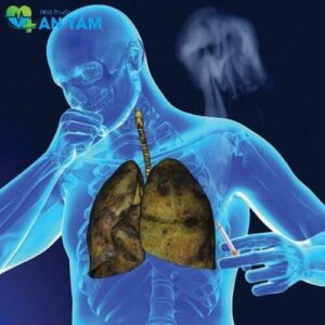 Ung thư phổi có lây không?