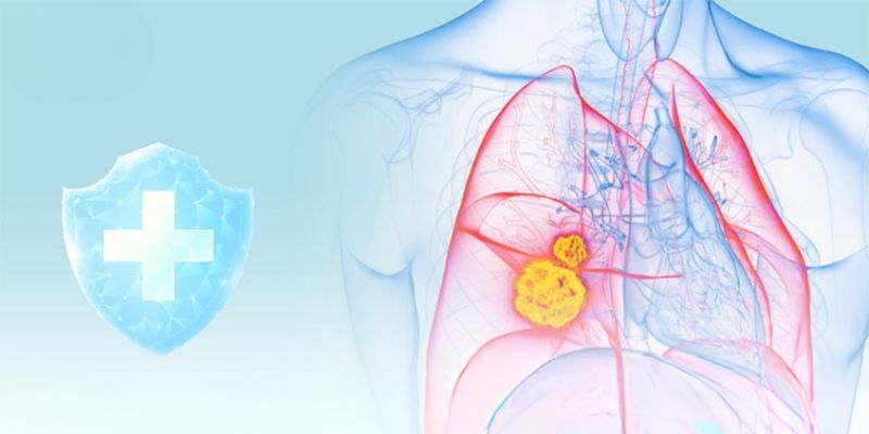 Tác dụng phụ của liệu pháp miễn dịch trong ung thư  Viêm phổi