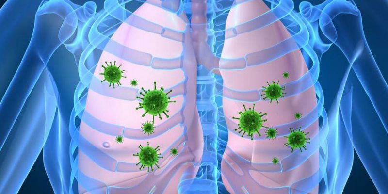 Viêm Màng Phổi là gì?